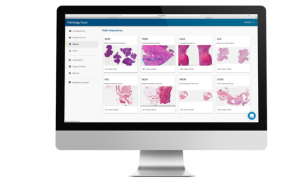 Proscia uses AI powered Digital Pathology for cancer screening