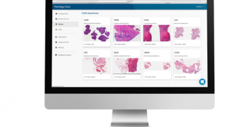 Proscia uses AI-powered Digital Pathology for Cancer Screening Proscia uses AI powered Digital Pathology for cancer screening