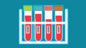 diabetes diagnosis using machine learning